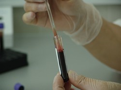 blood analysis performed in Huxley IA lab